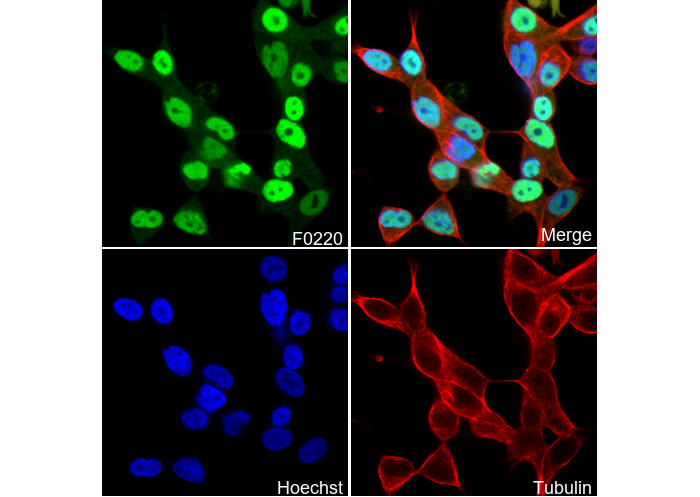 Androgen Receptor Antibody
