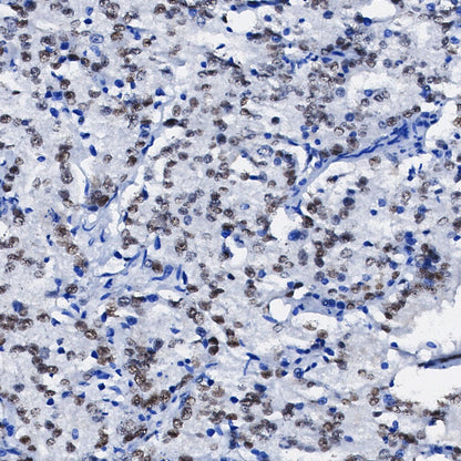 Androgen Receptor Antibody