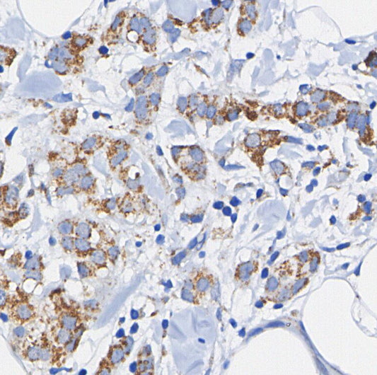 GRP78/BIP Antibody