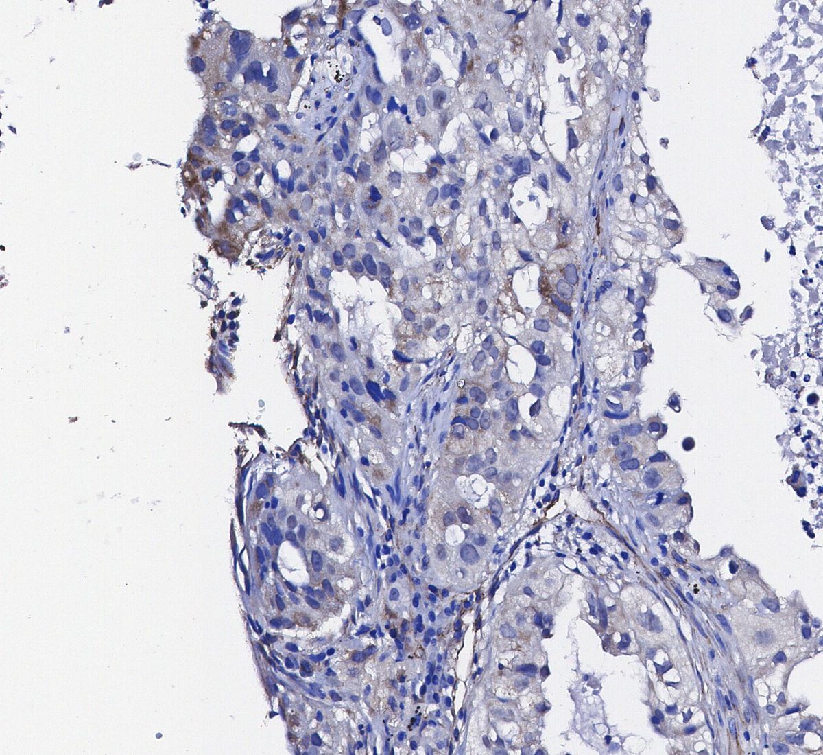 Caveolin-1 Antibody