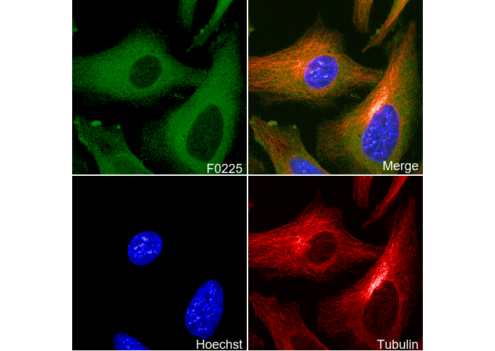 Fatty Acid Synthase Antibody