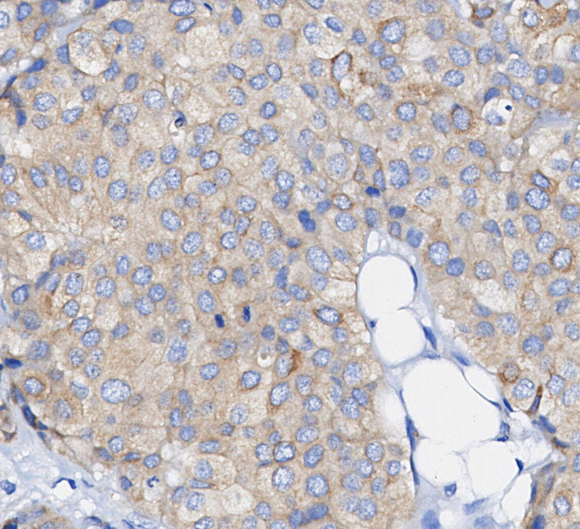 Fatty Acid Synthase Antibody