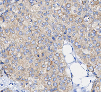 Fatty Acid Synthase Antibody
