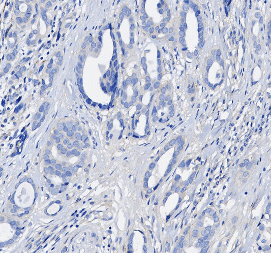 HER2/ErbB2 Antibody