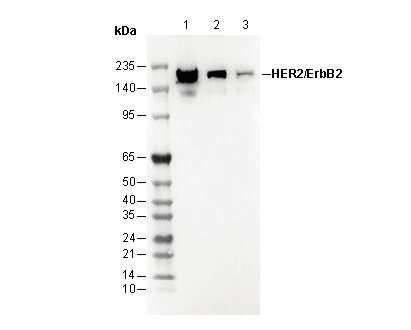 HER2/ErbB2 Antibody