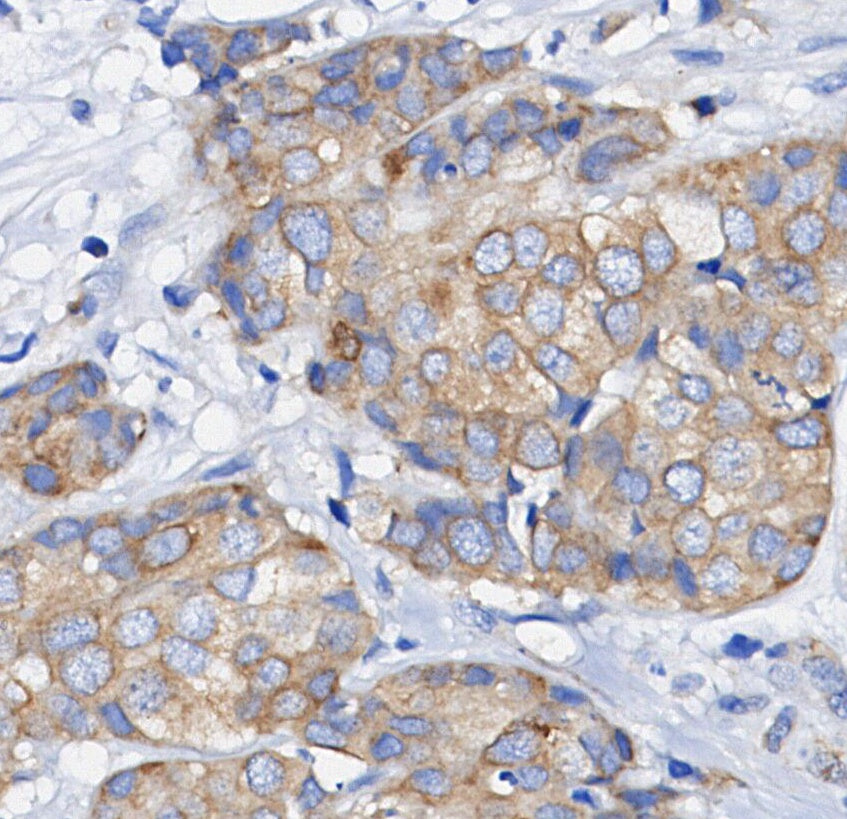 JAK2 Antibody