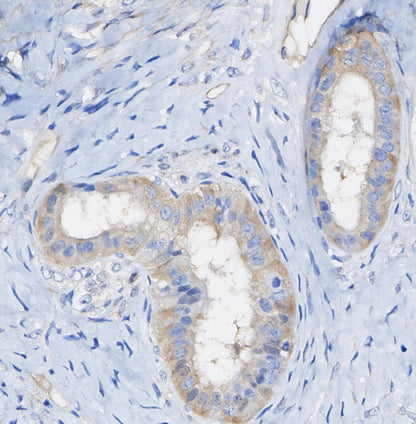 PRAS40 Antibody