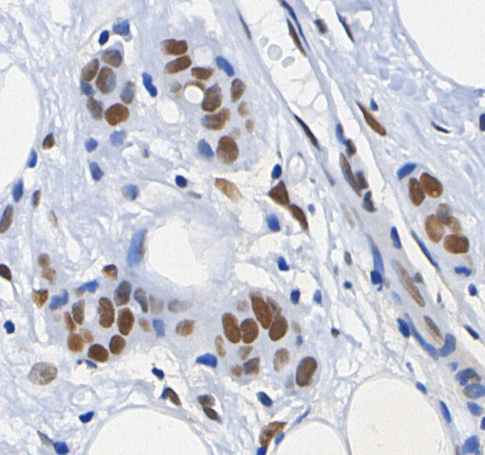 Phospho-Chk2 (Thr68) Antibody