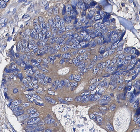 Phospho-IGF-1R (Y1135/1136)/IR (Y1150/1151) Antibody