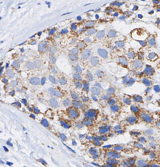 Phospho-PRAS40 (Thr246) Antibody
