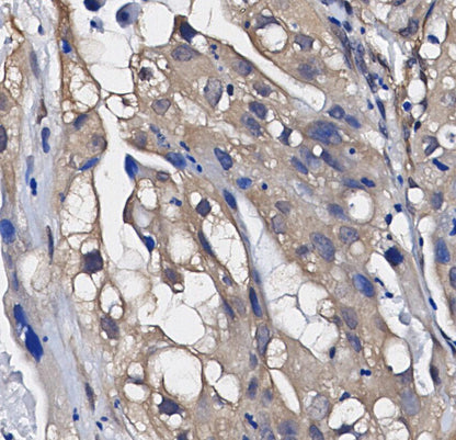 Phospho-eIF2α (Ser51) Antibody