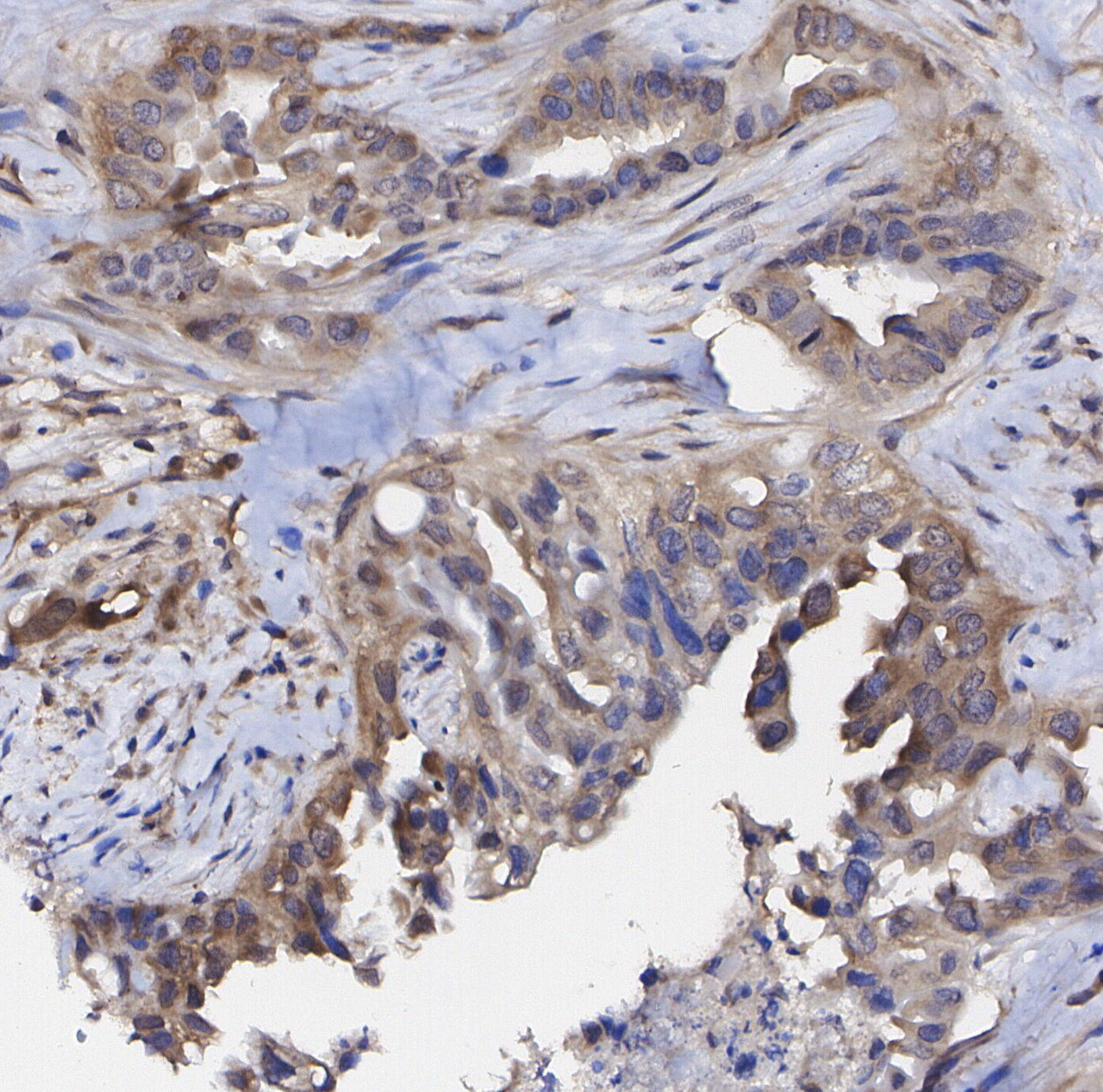 Rictor Antibody