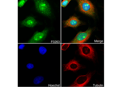 Stat1 Antibody