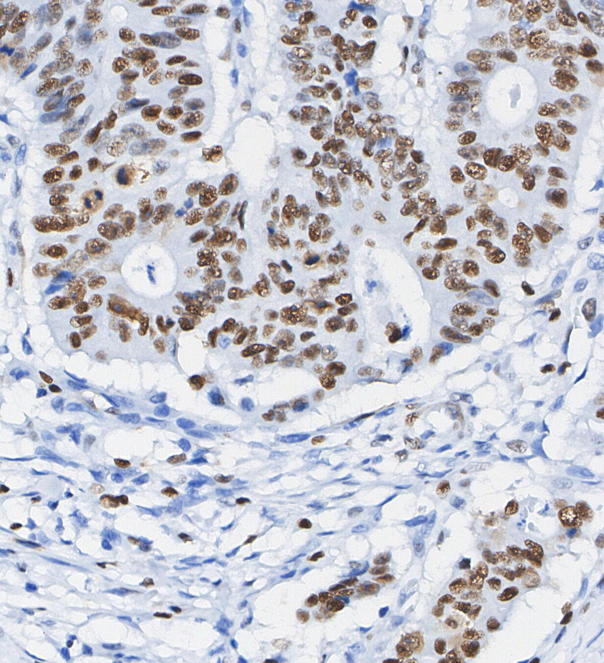 Survivin Antibody