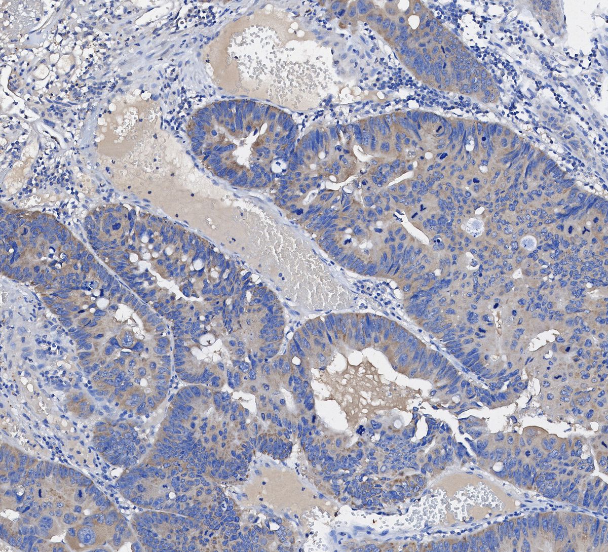 Acetyl-CoA Carboxylase Antibody