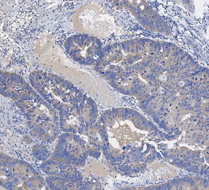 Acetyl-CoA Carboxylase Antibody