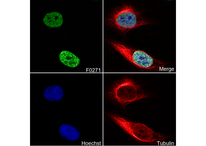 Acetyl-Histone H3 (Lys27) Antibody