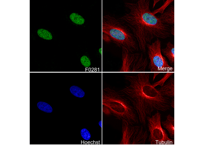 Ezh2 Antibody