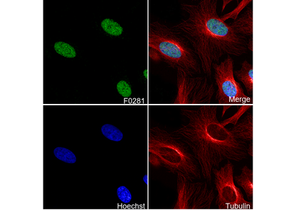 Ezh2 Antibody