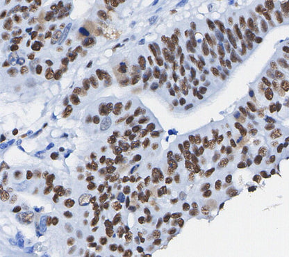Ezh2 Antibody