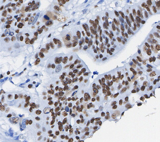 Ezh2 Antibody