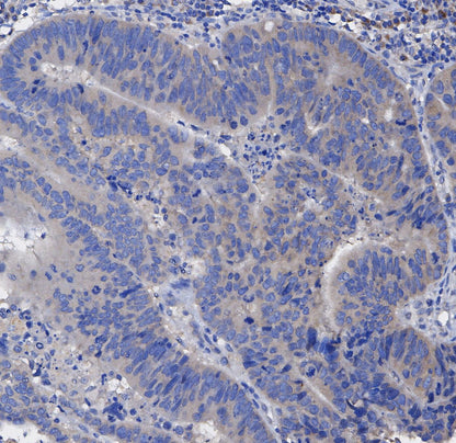 Met Antibody