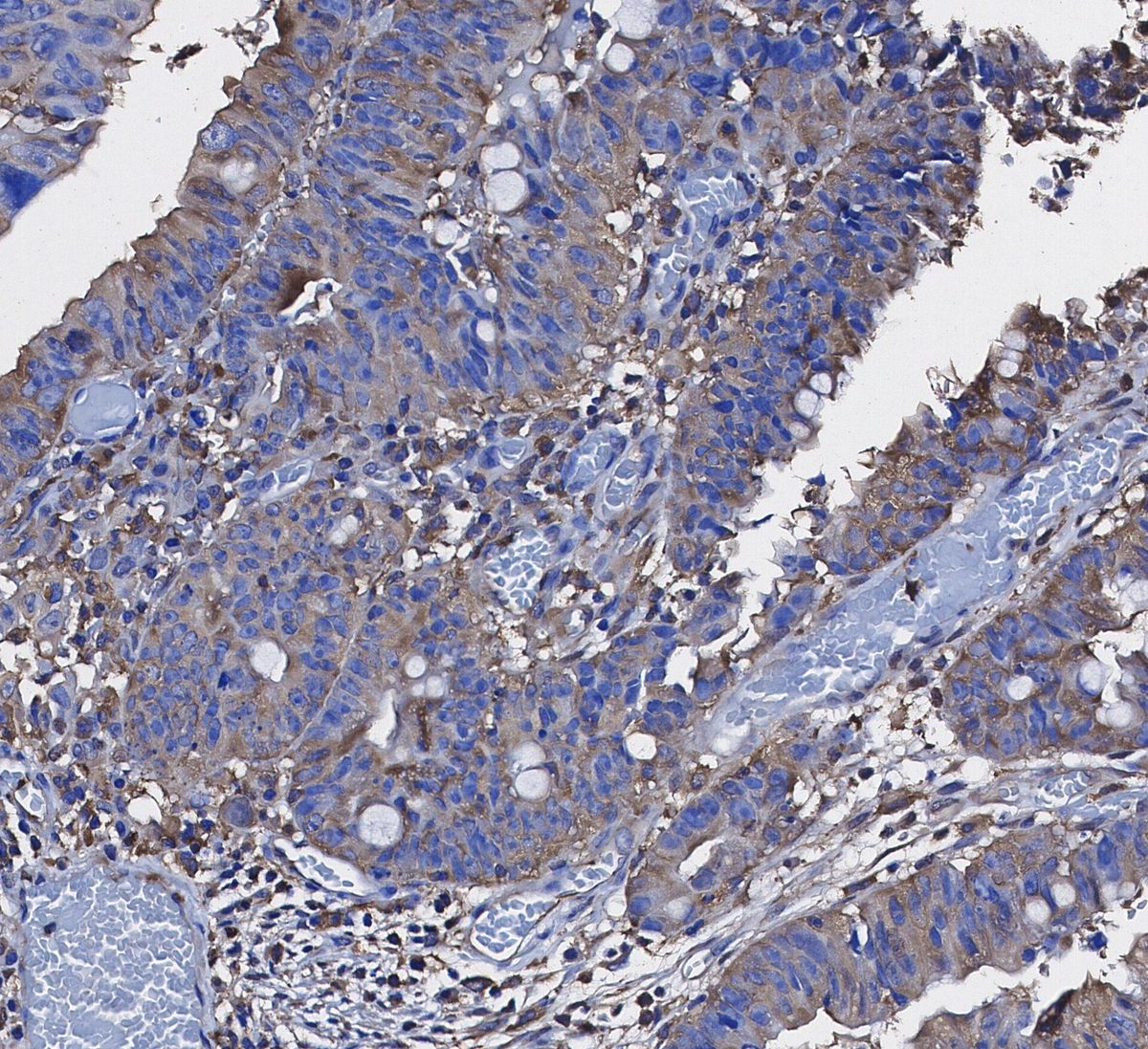 PKM2 Antibody