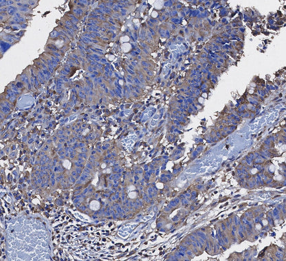 PKM2 Antibody