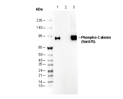 Phospho-β-Catenin (Ser675) Antibody