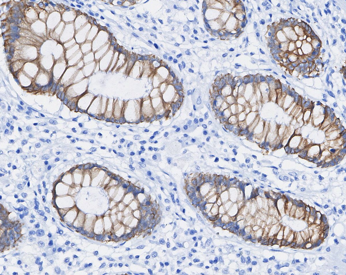 Phospho-EGF Receptor (Tyr1068) Antibody