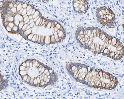 Phospho-EGF Receptor (Tyr1068) Antibody