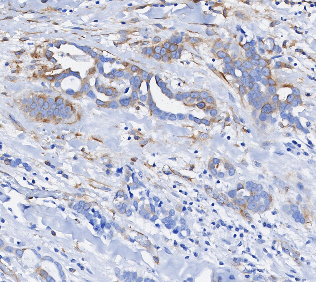 Phospho-S6 Ribosomal Protein (Ser240/244) Antibody