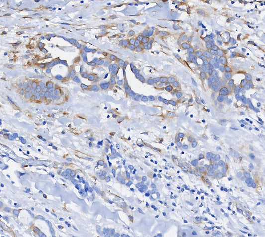Phospho-S6 Ribosomal Protein (Ser240/244) Antibody