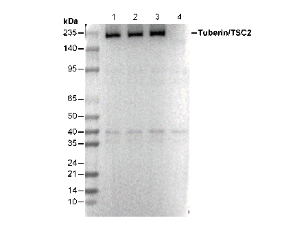 Tuberin/TSC2 Antibody