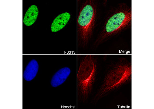 Ubiquityl-Histone H2A (Lys119) Antibody