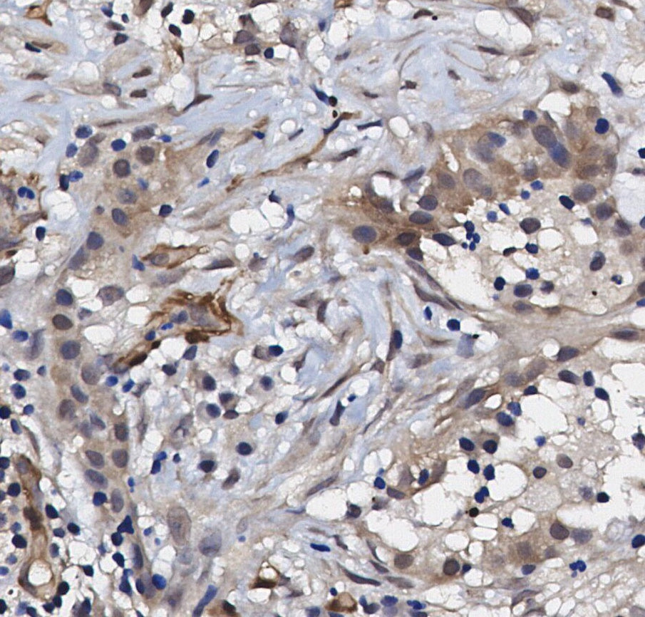 VDAC Antibody
