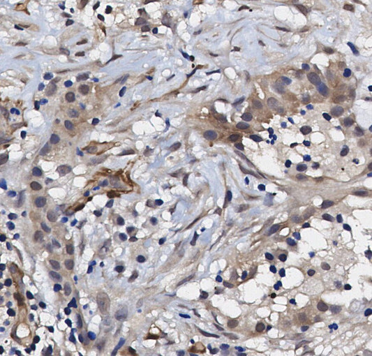 VDAC Antibody