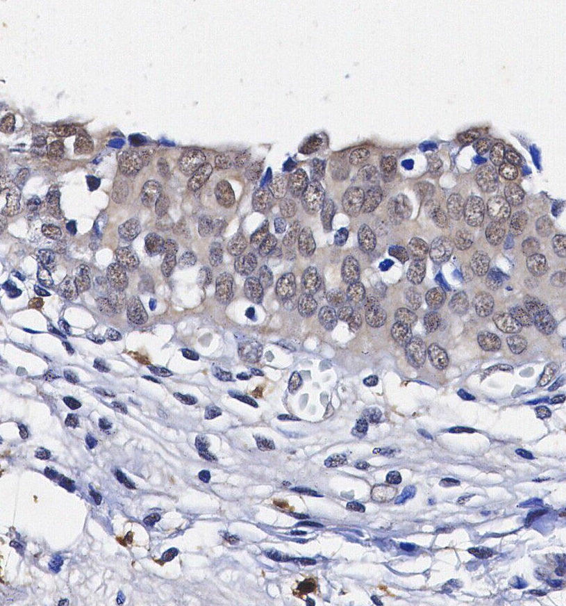 CDK4 Antibody