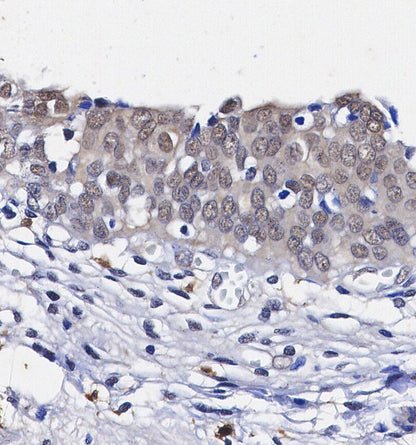 CDK4 Antibody