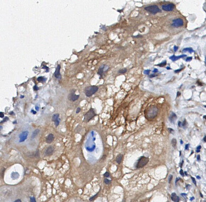 COX2 / Cyclooxygenase 2 Antibody