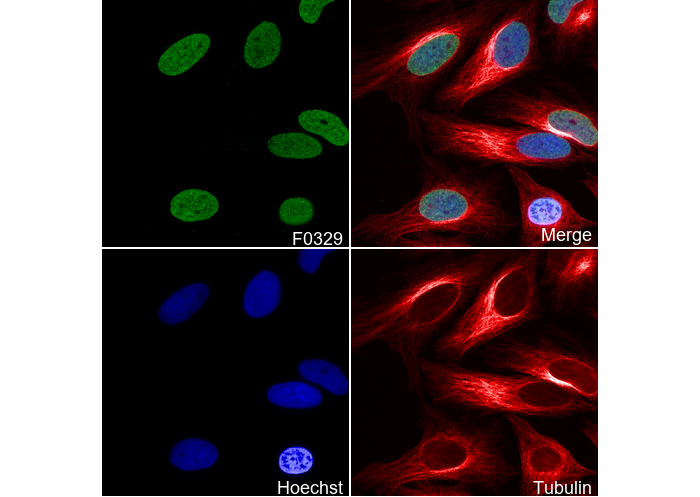 Histone H3 (di methyl Lys27) Antibody