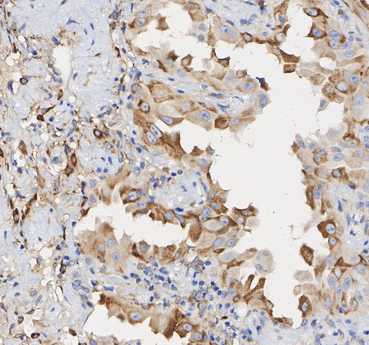 FGF Receptor 1 Antibody