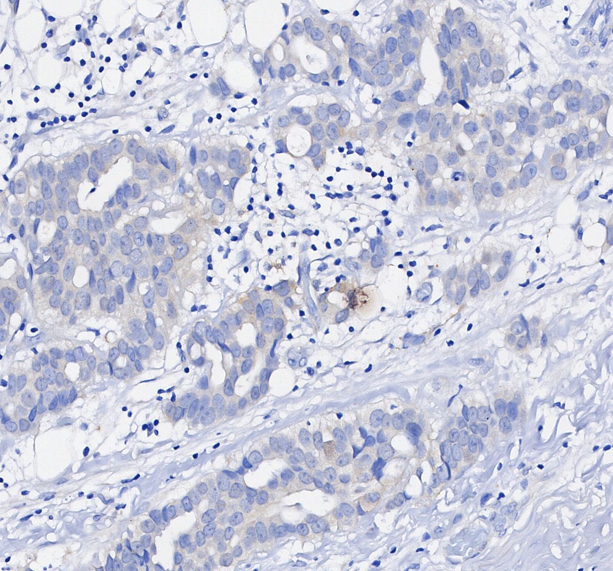 Non-phospho β-Catenin (S33/37/T41) Antibody