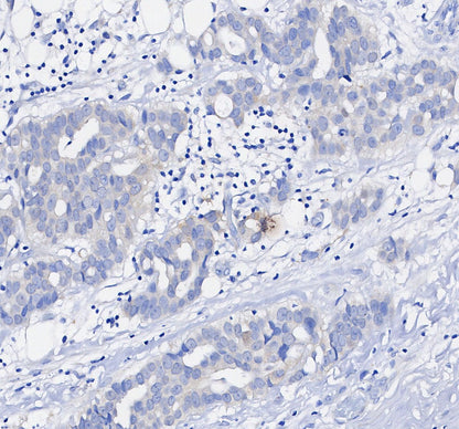 Non-phospho β-Catenin (S33/37/T41) Antibody