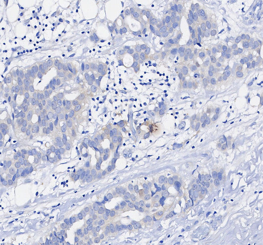 Non-phospho β-Catenin (S33/37/T41) Antibody