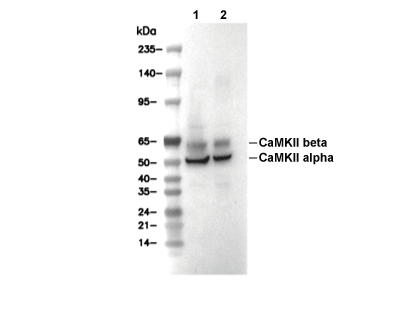 Phospho-CaMKII (Thr286) Antibody