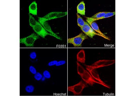 Phospho-ULK1 (Ser757) Antibody