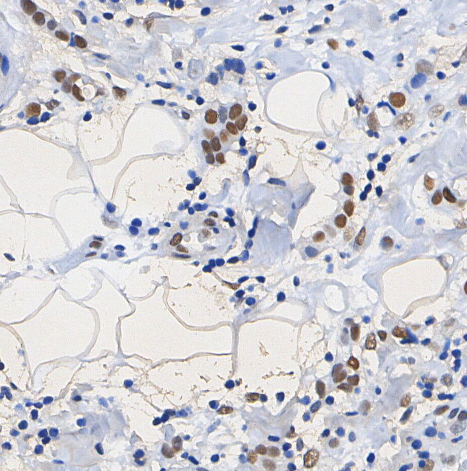 Histone H3 (tri methyl Lys4) Antibody