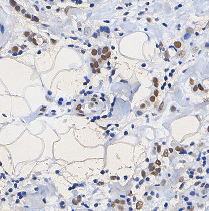 Histone H3 (tri methyl Lys4) Antibody