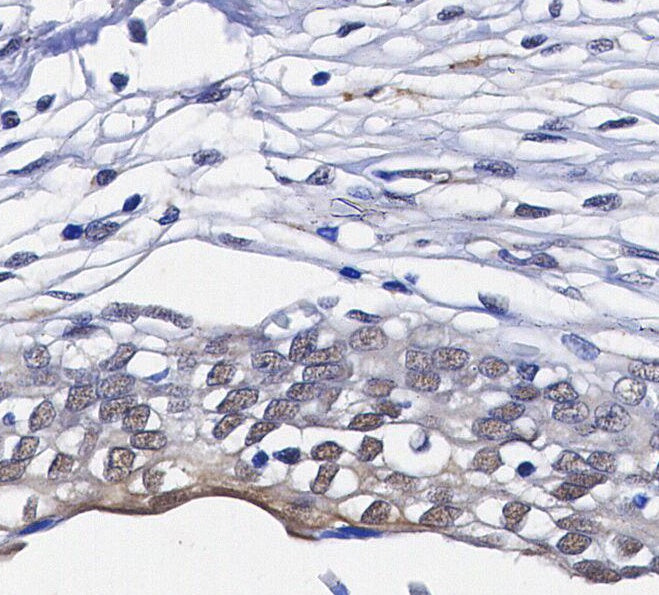 YAP Antibody
